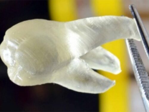 SALUTE: I denti stampati in 3D che proteggono dalle carie