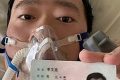 CRONACA: Annunciò il coronavirus, morto il medico cinese che non venne creduto